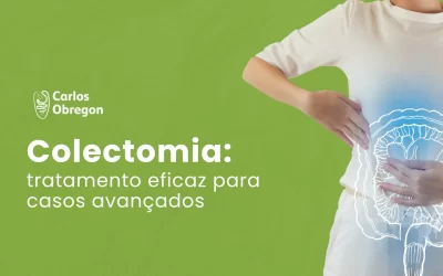 Colectomia: tratamento eficaz para casos avançados