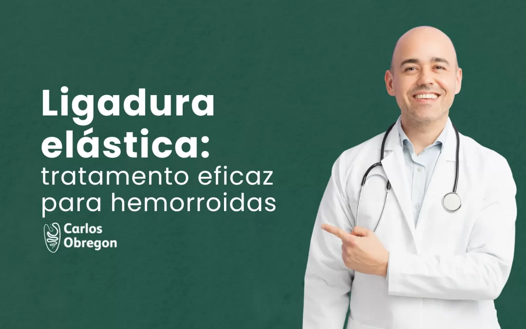 Ligadura elástica: tratamento eficaz para hemorroidas