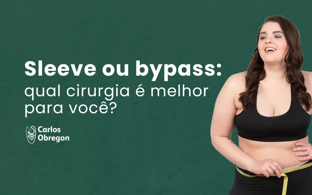 Sleeve ou bypass gástrico: qual cirurgia é melhor para você?