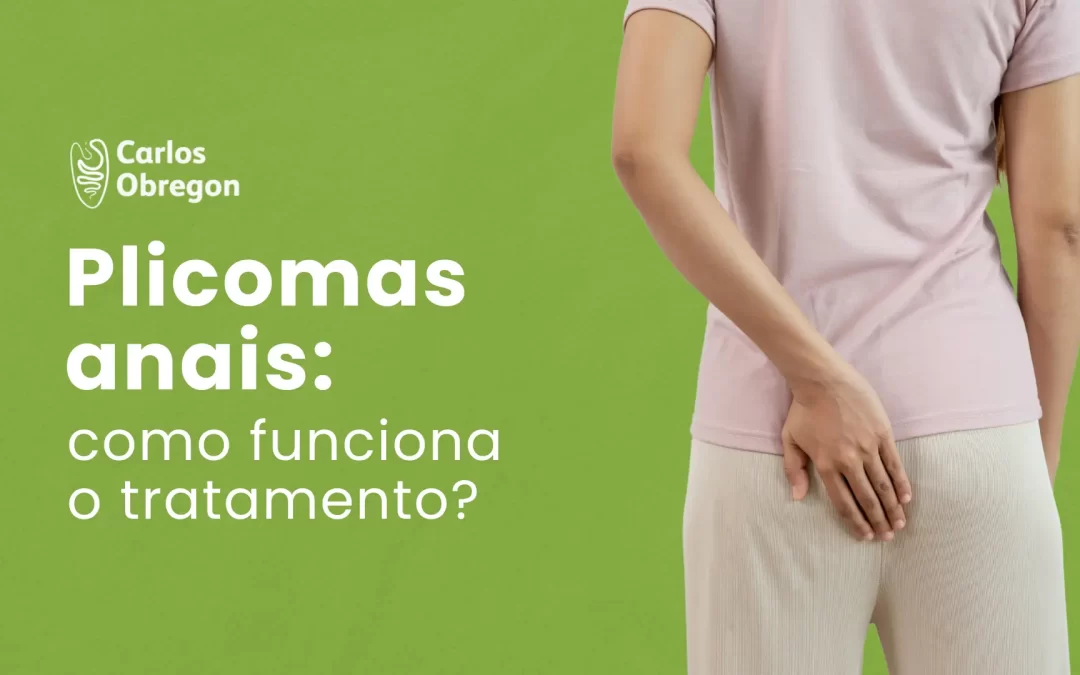 Plicomas anais: como realizar o tratamento?