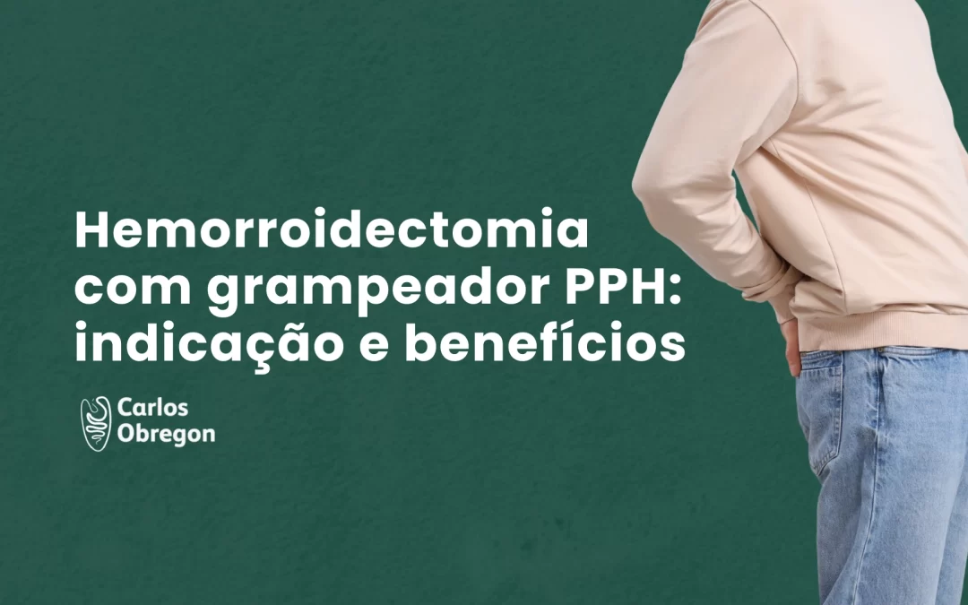 Hemorroidectomia com grampeador PPH: indicação e benefícios