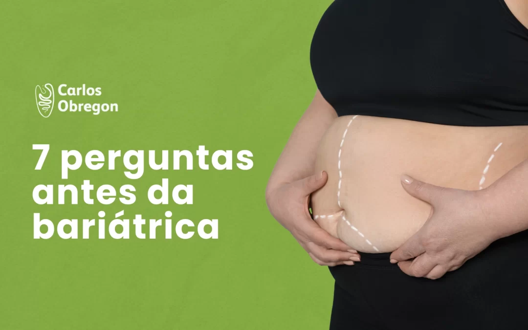7 perguntas que você deve fazer antes da bariátrica