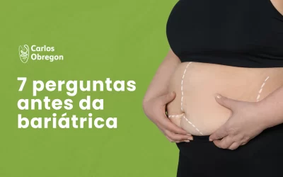 7 perguntas que você deve fazer antes da bariátrica