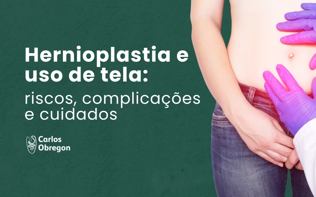 Hernioplastia e uso de tela: riscos e resultados