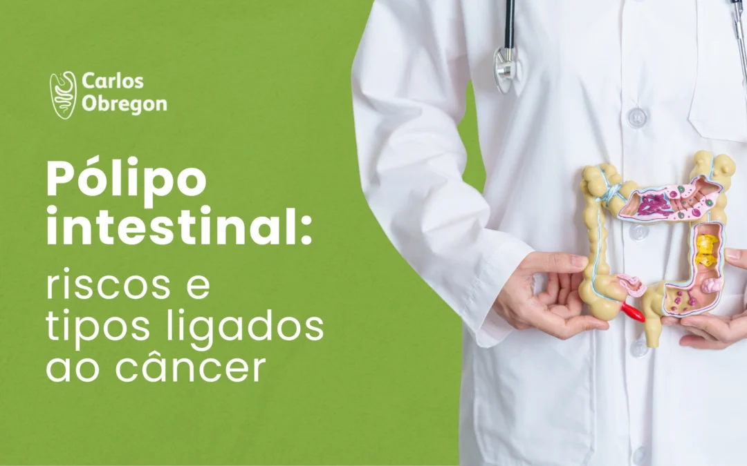 Pólipo intestinal: quando há risco de câncer?