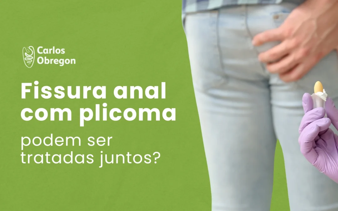Fissura anal com plicoma: os dois podem ser tratadas juntos?